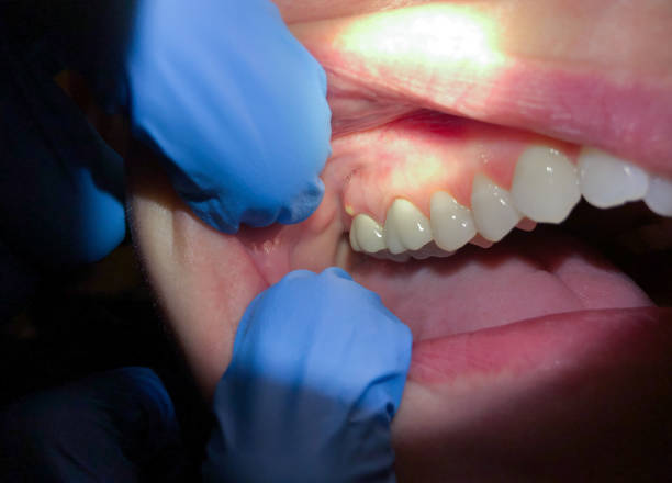 Best After-Hours Dental Trauma Care in Mount Olive, NC