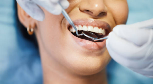 Best Emergency Tooth Extraction in Mount Olive, NC