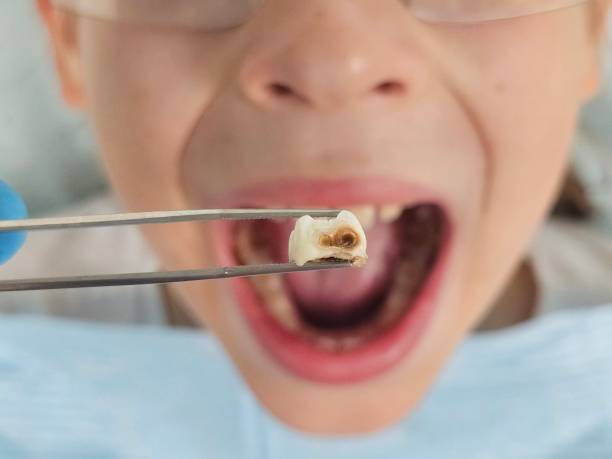 Best Emergency Dental Care for Broken or Chipped Teeth in Mount Olive, NC